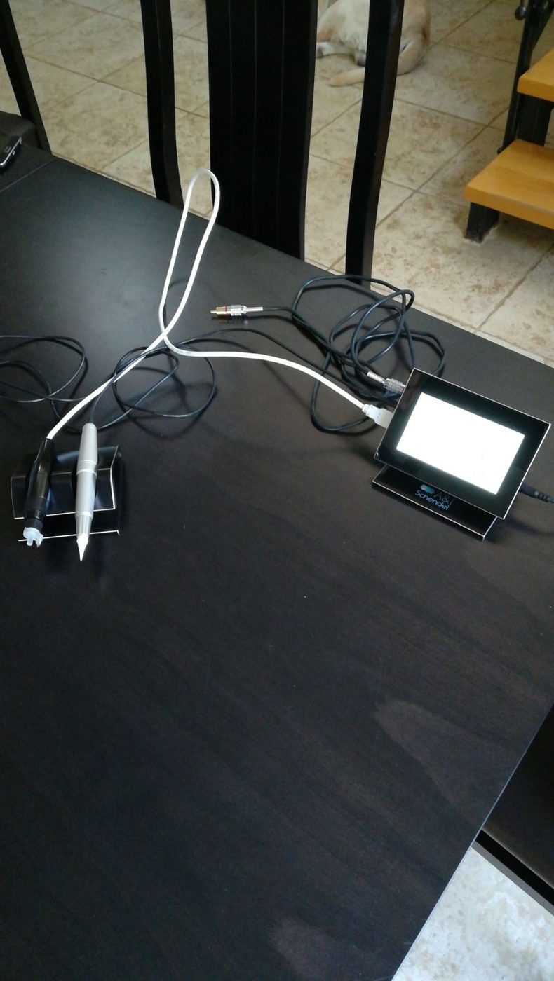 Tattoo assist device — project photo 5